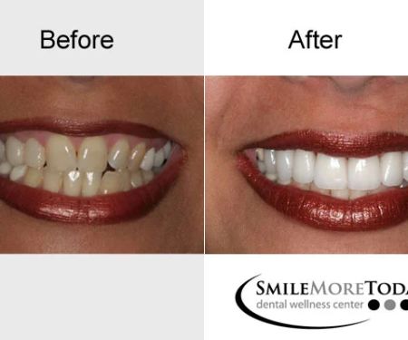 Smile More Today