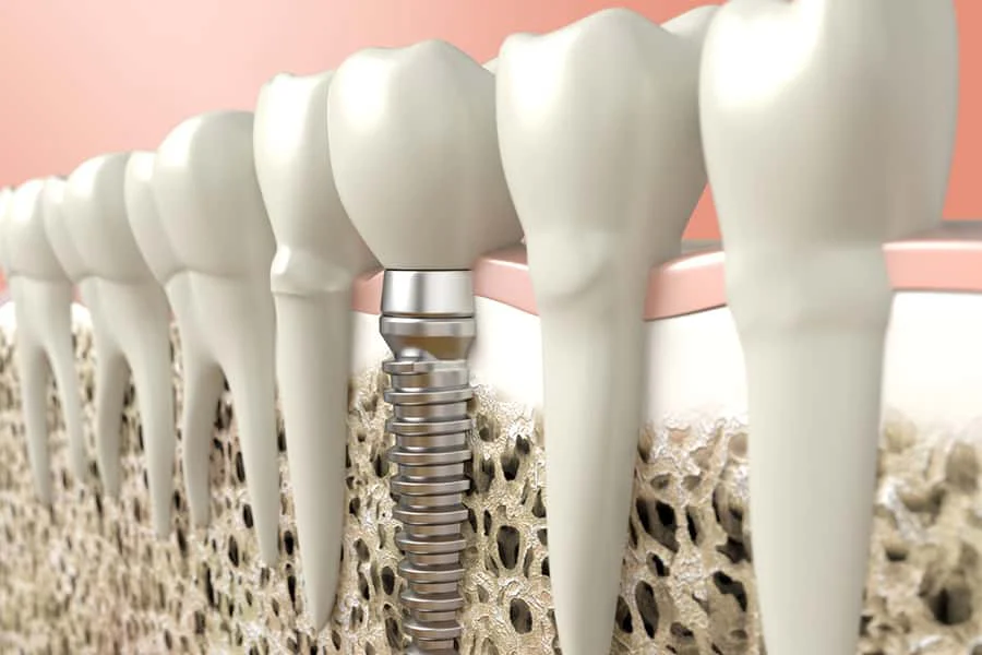 Innovative Periodontics & Implants: Donald G Flynn, DDS 3