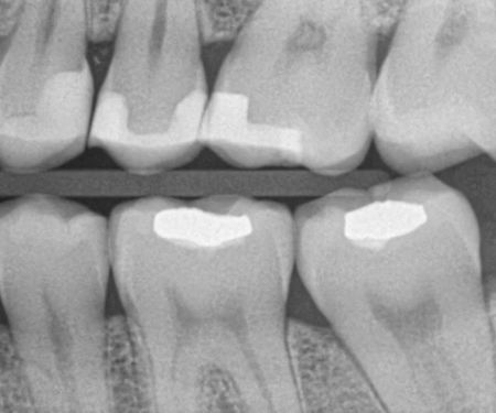 My Smiles Dental Center