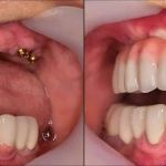 Plymouth Center for Dental Health and Wellness