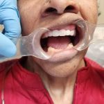 Long Beach Dental Arts, PC