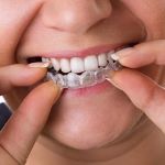 Gentle Dental Service