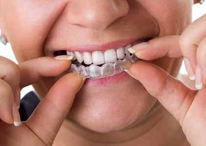 Gentle Dental Service