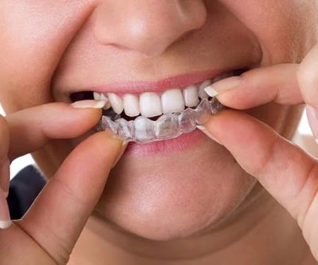 Gentle Dental Service