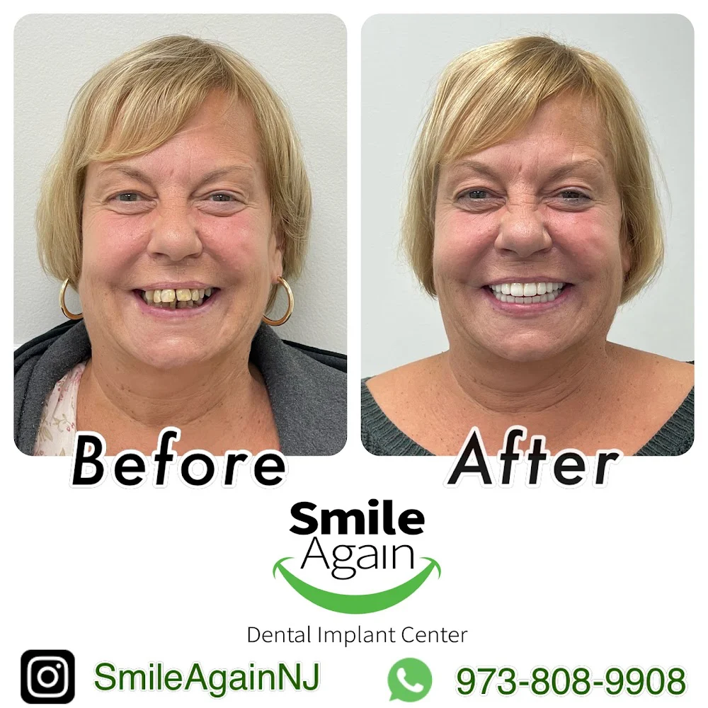 Smile Again Dental Implant Center 10