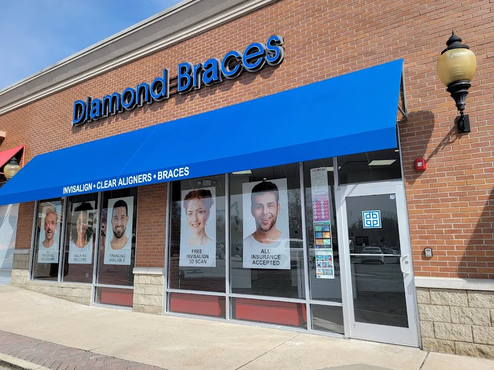 Diamond Braces Orthodontist: Braces & Invisalign 4