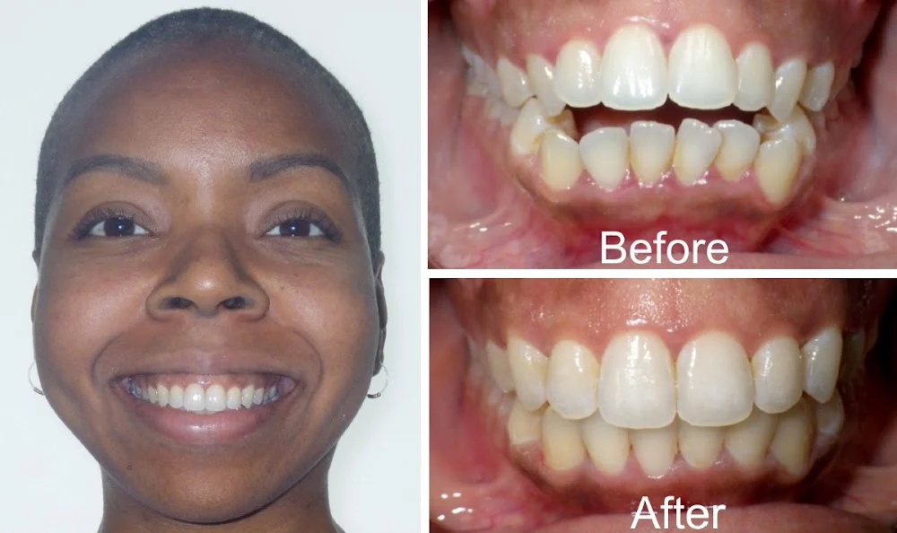 Diamond Braces Orthodontist: Braces & Invisalign 10