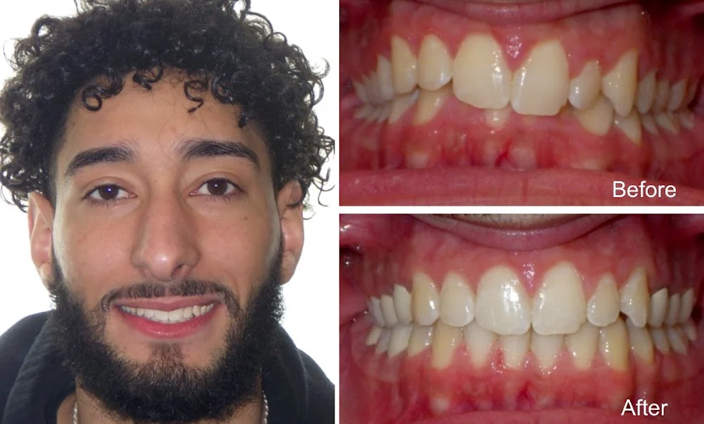 Diamond Braces Orthodontist: Braces & Invisalign 8