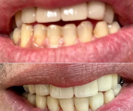 TK Dental Wayne, NJ | General, Cosmetic, Restorative Dentists. Dental Implants, Crowns, Bridges | Tatyana Kaminar DDS