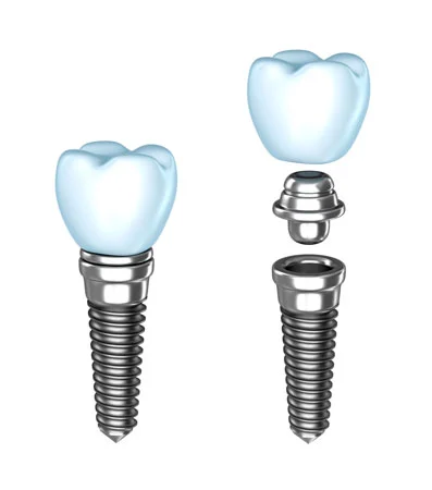 Pompton Plains Oral Surgery Picture 10