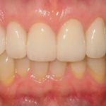 Cahill Dental Care