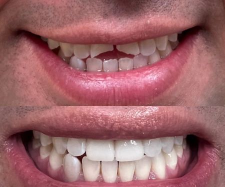 Lakeshore Dental