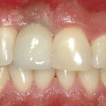 Robert S. Radin, DDS