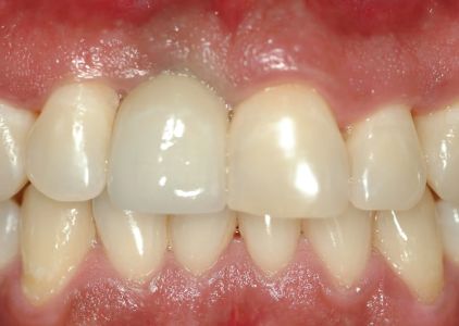 Robert S. Radin, DDS