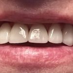 Lind Dental Care