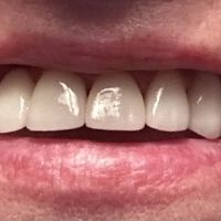 Lind Dental Care ico