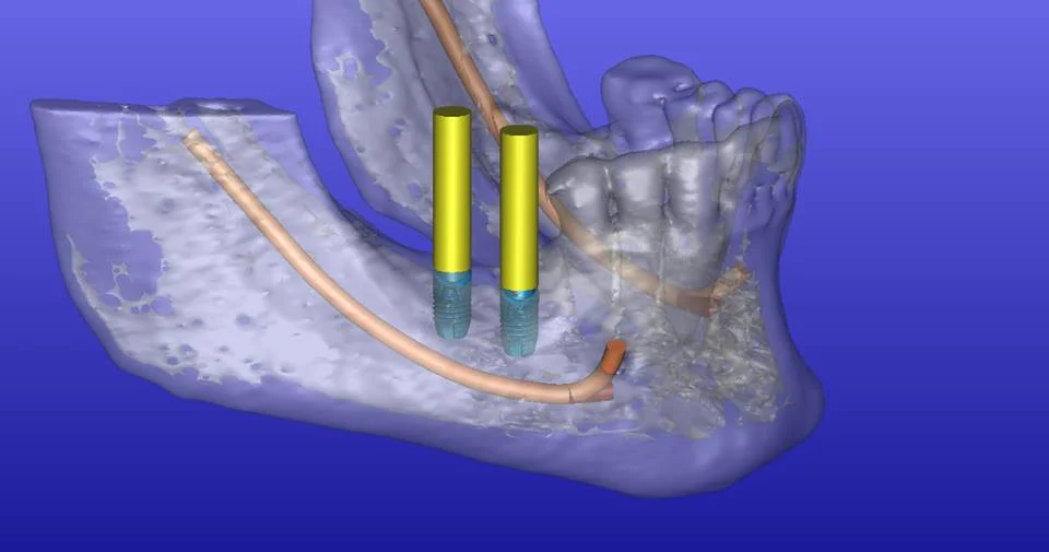 Seven Hills Dental & Implant Center 3