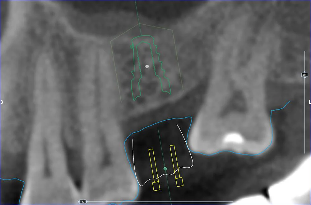 Dentist Riverside - TranscenDental Smiles 8