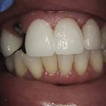 Smile Dental of New Rochelle