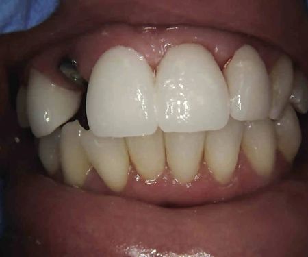 Smile Dental of New Rochelle