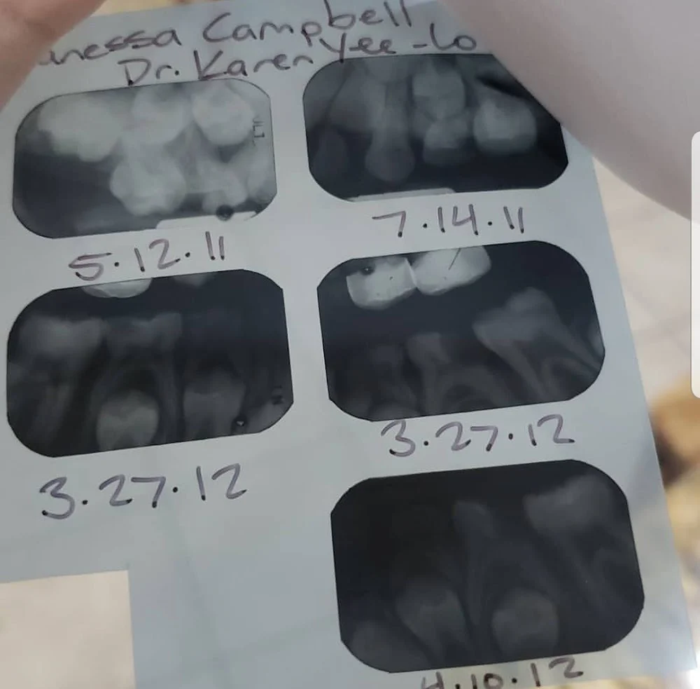 Lo Family Dental 6