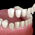 Tacoma Dental Care, Dr. Thi Truong Nguyen, DMD.