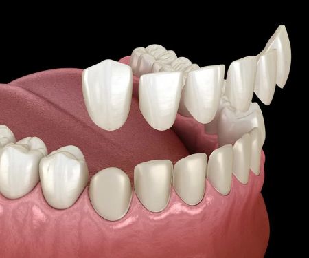 Tacoma Dental Care, Dr. Thi Truong Nguyen, DMD.