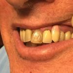 NorthStar Implant Dentistry