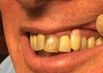 NorthStar Implant Dentistry