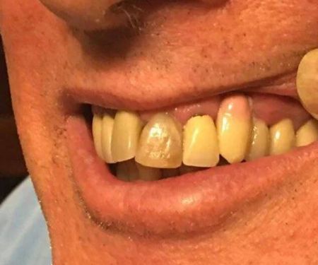 NorthStar Implant Dentistry