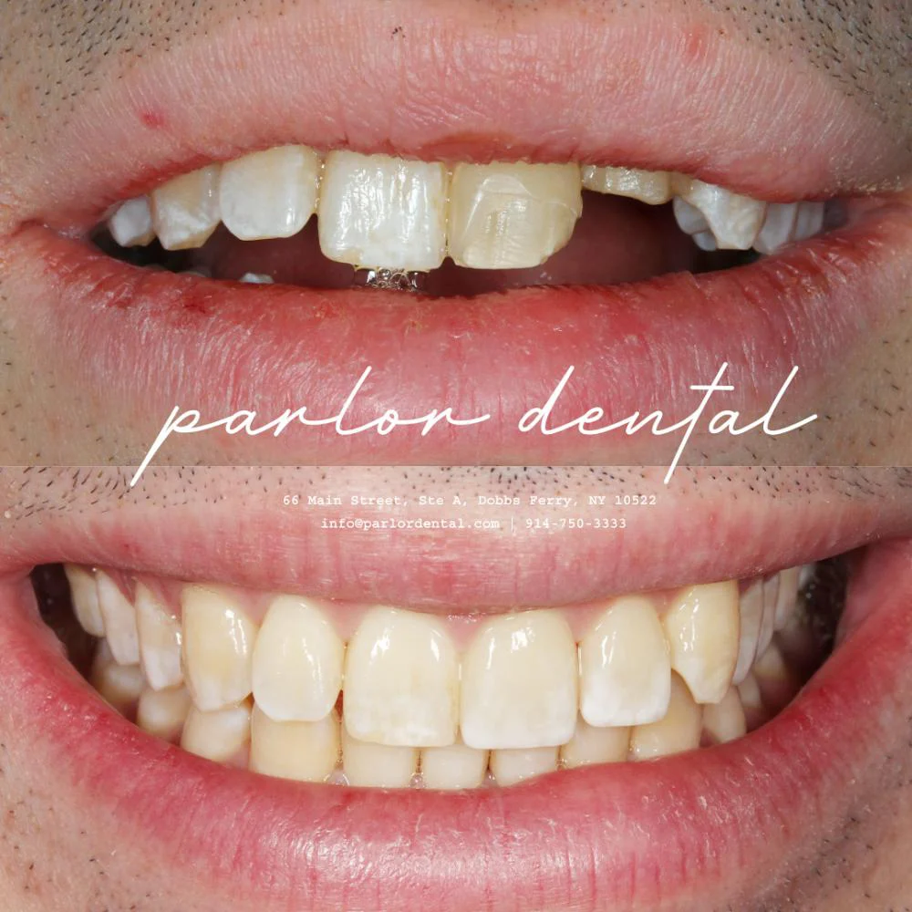 Parlor Dental 10