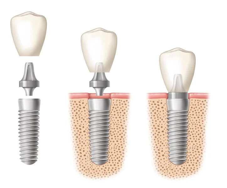 Grand Avenue Family Dental 4