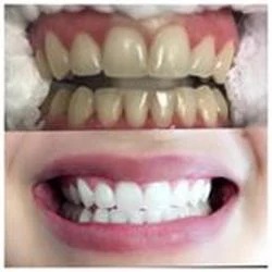 All Smiles Family Dental - Dr Sandhya Pallam DDS 10