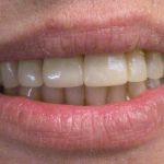 Marshall A. Polan DDS