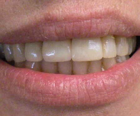 Marshall A. Polan DDS