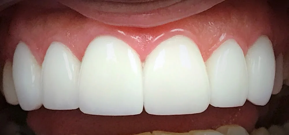 Dr. Fernando Tordoya, DDS,FAGD AFAAID 5