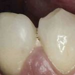 Bob and Peg's Dental