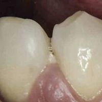 Bob and Peg's Dental ico