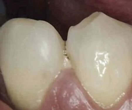 Bob and Peg's Dental