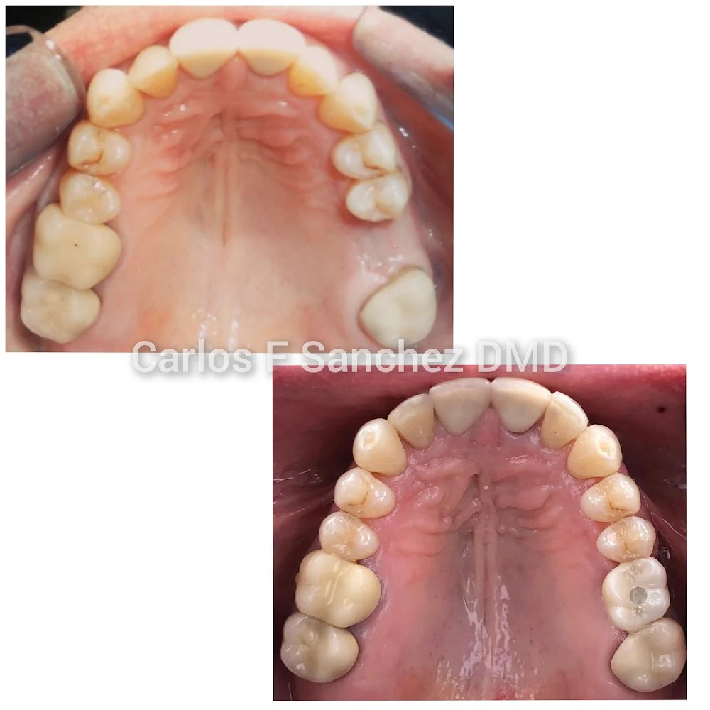 Penndel Dental -- Carlos F. Sanchez DMD 5