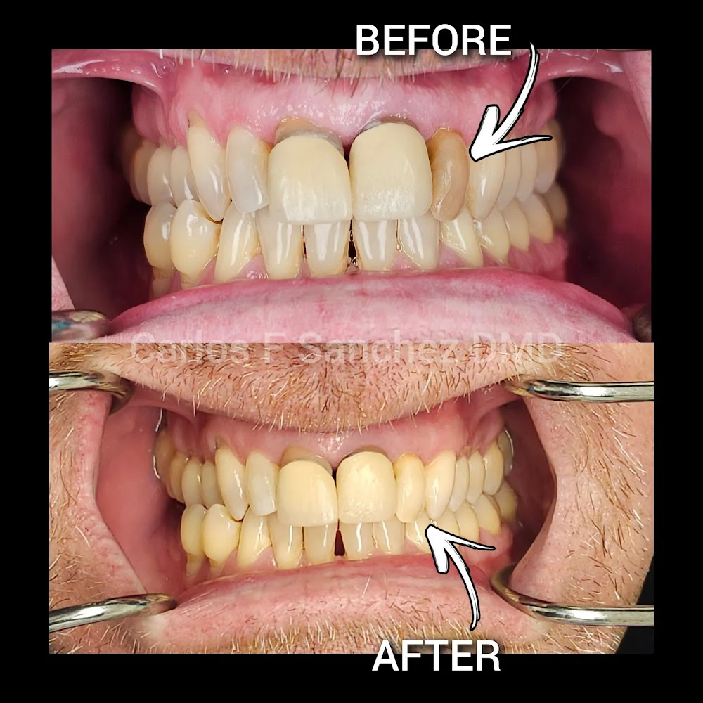 Penndel Dental -- Carlos F. Sanchez DMD 2