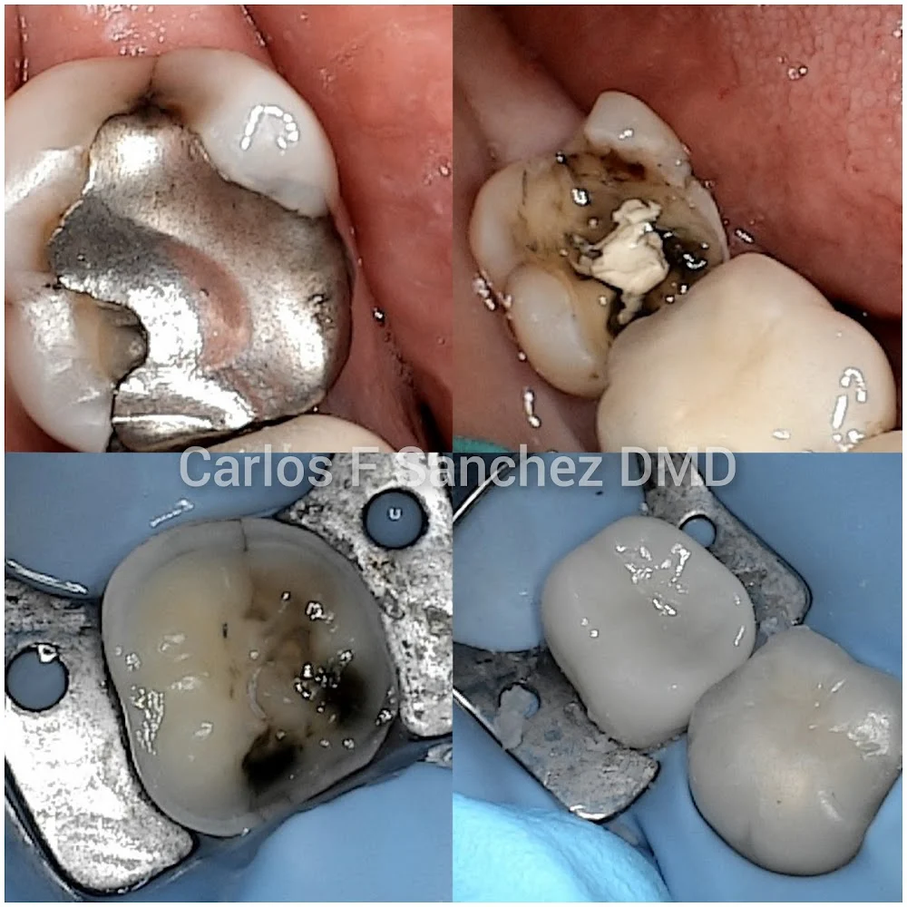 Penndel Dental -- Carlos F. Sanchez DMD 9