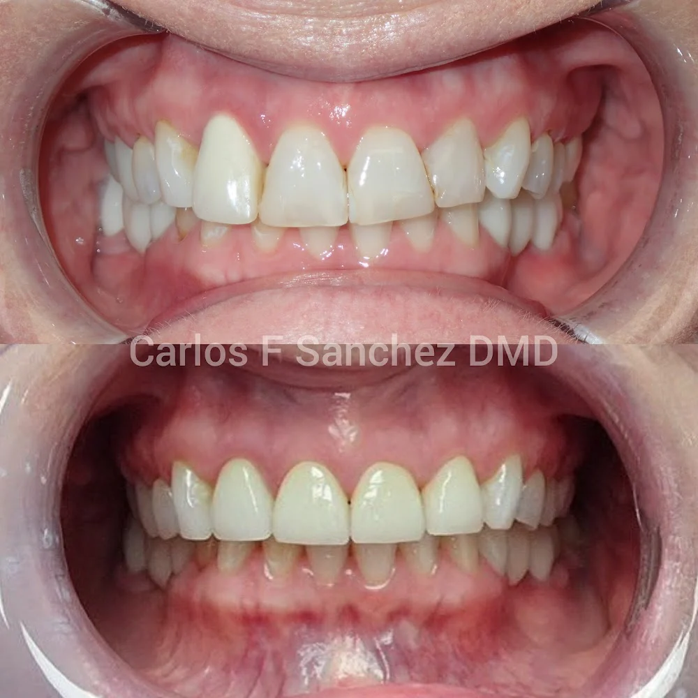 Penndel Dental -- Carlos F. Sanchez DMD 10