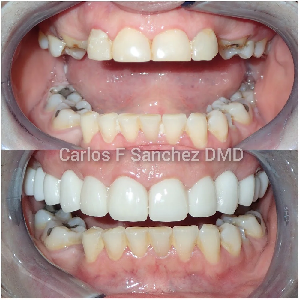 Penndel Dental -- Carlos F. Sanchez DMD 8