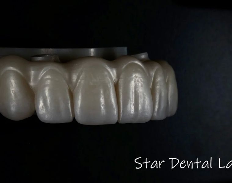 Star Dental Lab