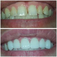Ace Dental Center ico