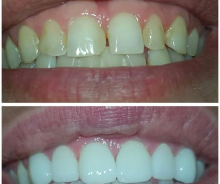 Ace Dental Center