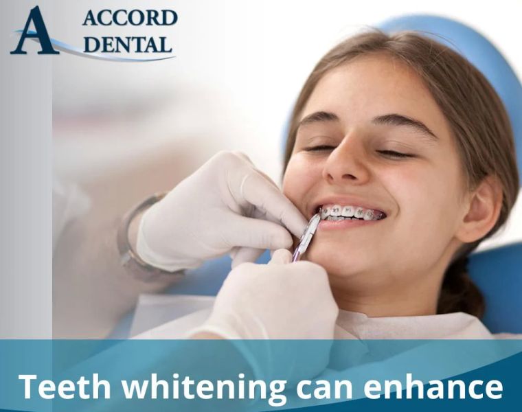 Dentist in Grafton, MA | Accord Dental | Emergency and Cosmetic Dentist in Grafton