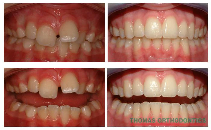 Thomas Orthodontics 10