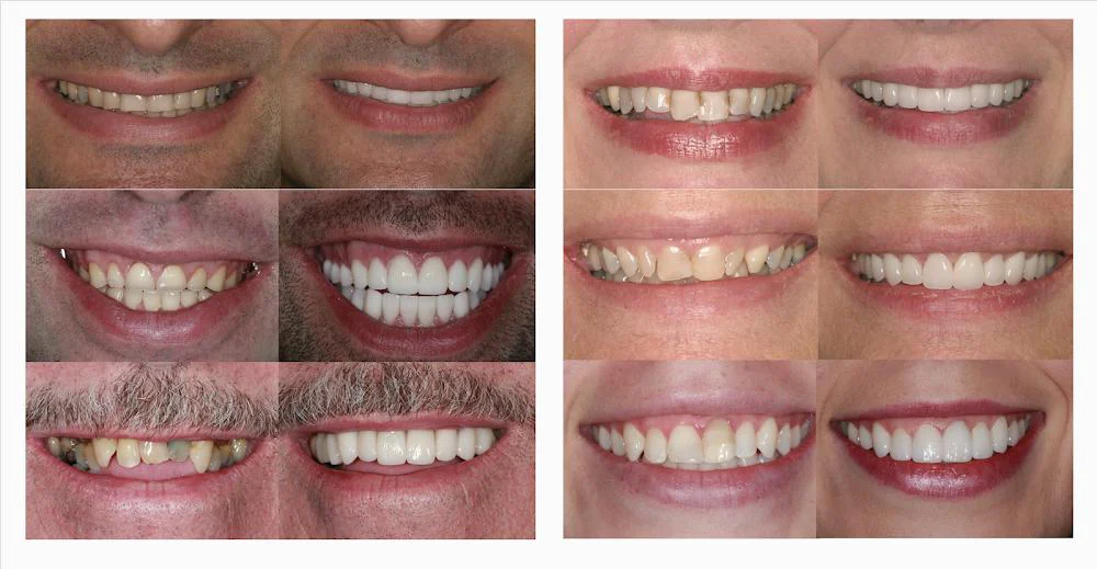 Perfect Smiles, PLLC, Dr. Houghton, Dr. Tamminidi, Dr. Sai 6